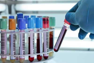 Laboratorio a domicilio en Lima